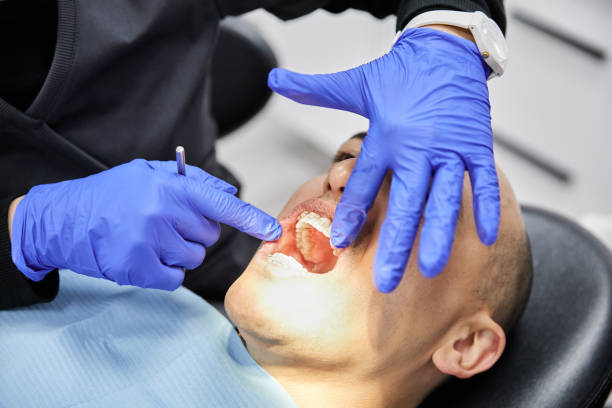 Best Emergency Tooth Extraction in Fairwood, MD